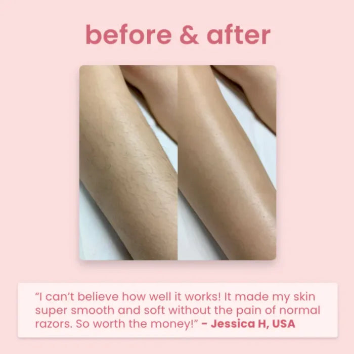 Women’s 4-in-1 Electric Hair Remover & Body Shaver